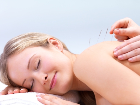 Acupuncture Treatment