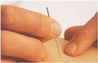 Needle the width of a human hair picture
